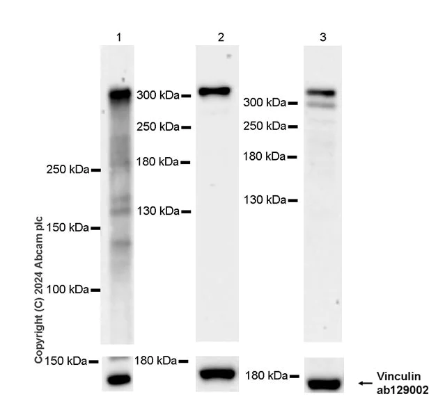Western blot - Anti-RanBP2 antibody [RM2047] - BSA and Azide free (AB316337)