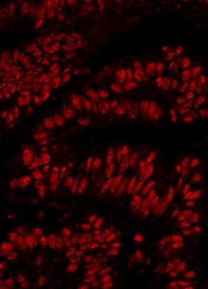 Immunohistochemistry (Formalin/PFA-fixed paraffin-embedded sections) - Anti-RanBP3 antibody (AB241502)