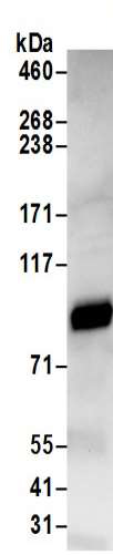 Immunoprecipitation - Anti-RanBP9 antibody (AB205954)