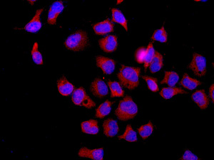 Immunocytochemistry/ Immunofluorescence - Anti-RanBP9 antibody [EPR9920(B)] (AB140627)