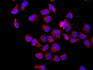 Immunocytochemistry/ Immunofluorescence - Anti-RanBP9 antibody [EPR9920(B)] - BSA and Azide free (AB248912)
