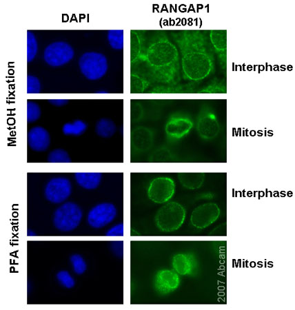 Immunocytochemistry/ Immunofluorescence - Anti-RanGAP1 antibody (AB2081)