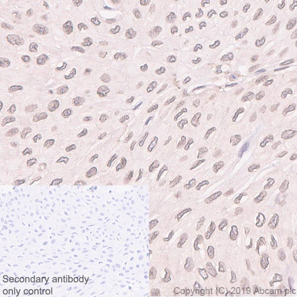 Immunohistochemistry (Formalin/PFA-fixed paraffin-embedded sections) - Anti-RanGAP1 antibody [EPR3295] (AB92360)