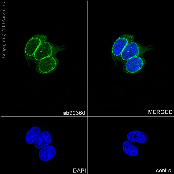 Immunocytochemistry/ Immunofluorescence - Anti-RanGAP1 antibody [EPR3295] - BSA and Azide free (AB239907)