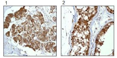 Immunohistochemistry (Formalin/PFA-fixed paraffin-embedded sections) - Anti-RanGAP1 antibody [EPR3295] - BSA and Azide free (ab239907), expandable thumbnail