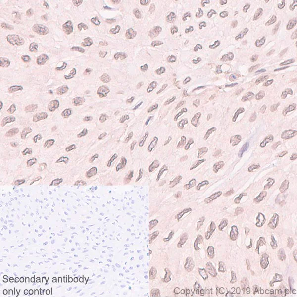 Immunohistochemistry (Formalin/PFA-fixed paraffin-embedded sections) - Anti-RanGAP1 antibody [EPR3295] - BSA and Azide free (AB239907)