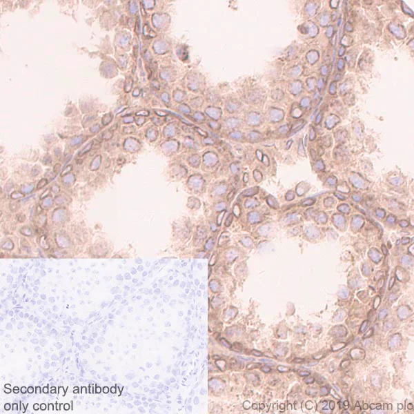 Immunohistochemistry (Formalin/PFA-fixed paraffin-embedded sections) - Anti-RanGAP1 antibody [EPR3295] - BSA and Azide free (AB239907)