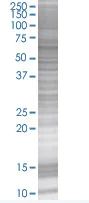 SDS-PAGE - RanGAP1 overexpression 293T lysate (whole cell) (AB94064)
