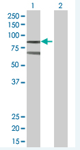 Western blot - RanGAP1 overexpression 293T lysate (whole cell) (AB94064), expandable thumbnail