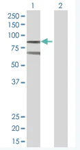 Western blot - RanGAP1 overexpression 293T lysate (whole cell) (AB94064)