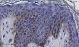 Immunohistochemistry (Formalin/PFA-fixed paraffin-embedded sections) - Anti-RANK antibody [64C1385] (AB13918), expandable thumbnail
