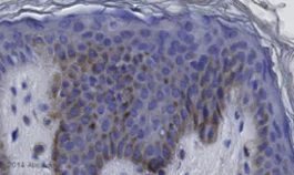 Immunohistochemistry (Formalin/PFA-fixed paraffin-embedded sections) - Anti-RANK antibody [64C1385] (AB13918)