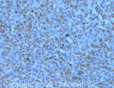 Immunohistochemistry (Formalin/PFA-fixed paraffin-embedded sections) - Anti-RANK antibody [64C1385] (AB13918)