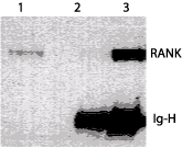 Immunoprecipitation - Anti-RANK antibody [64C1385] (AB13918), expandable thumbnail