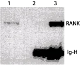 Immunoprecipitation - Anti-RANK antibody [64C1385] (AB13918)