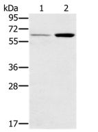 Western blot - Anti-RANK antibody (AB200369)