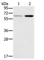 Western blot - Anti-RANK antibody (AB200369)