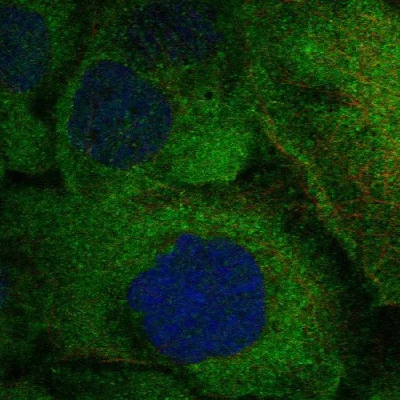 Immunocytochemistry/ Immunofluorescence - Anti-RANK antibody (AB222215)