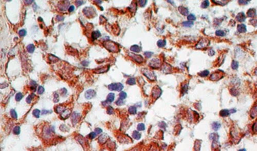 Immunohistochemistry (Formalin/PFA-fixed paraffin-embedded sections) - Anti-RANKL antibody [12A668] - BSA and Azide free (AB45039)