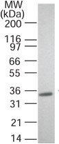 Anti-RANKL antibody [12A668] - BSA and Azide free