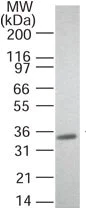 Western blot - Anti-RANKL antibody [12A668] - BSA and Azide free (AB45039)
