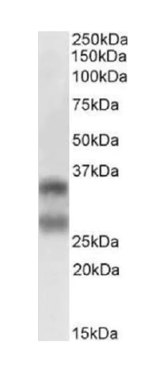Western blot - Anti-RANKL antibody [12A668] - BSA and Azide free (AB45039)