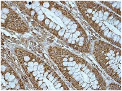Immunohistochemistry (Formalin/PFA-fixed paraffin-embedded sections) - Anti-RANKL antibody (AB169966), expandable thumbnail