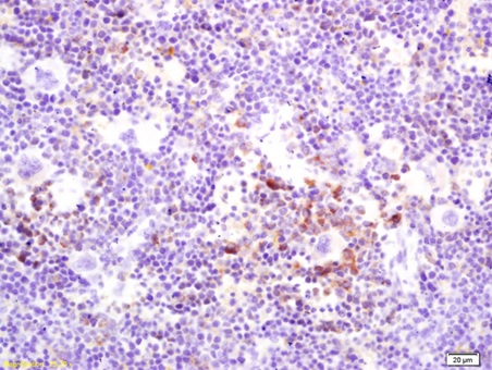 Immunohistochemistry (Formalin/PFA-fixed paraffin-embedded sections) - Anti-RANKL antibody (AB216484), expandable thumbnail