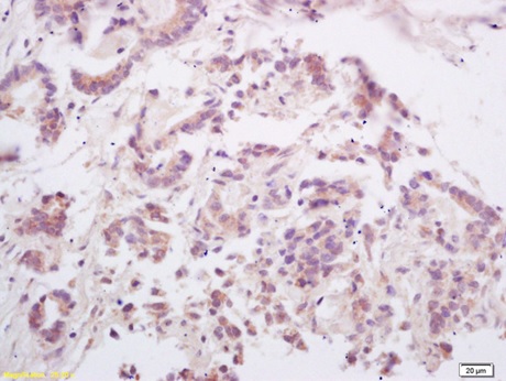 Immunohistochemistry (Formalin/PFA-fixed paraffin-embedded sections) - Anti-RANKL antibody (AB216484), expandable thumbnail