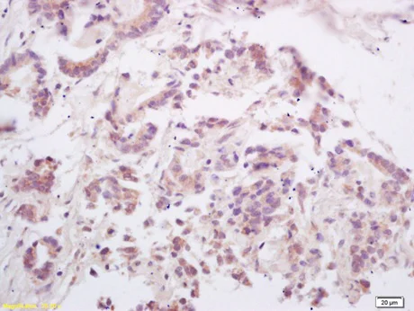 Immunohistochemistry (Formalin/PFA-fixed paraffin-embedded sections) - Anti-RANKL antibody (AB216484)