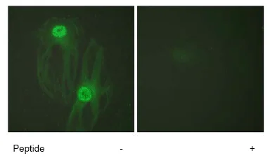 Immunocytochemistry/ Immunofluorescence - Anti-RANKL antibody (AB65024)