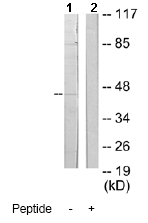Western blot - Anti-RANKL antibody (AB65024), expandable thumbnail