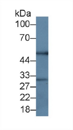 Western blot - Anti-RANKL antibody [C1] (AB239607), expandable thumbnail