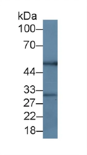 Western blot - Anti-RANKL antibody [C1] (AB239607)