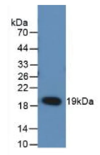 Western blot - Anti-RANKL antibody [C1] (AB239607)