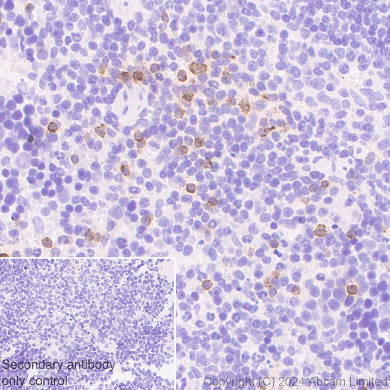Immunohistochemistry (Formalin/PFA-fixed paraffin-embedded sections) - Anti-RANTES antibody [EPR25836-32] (AB322195)