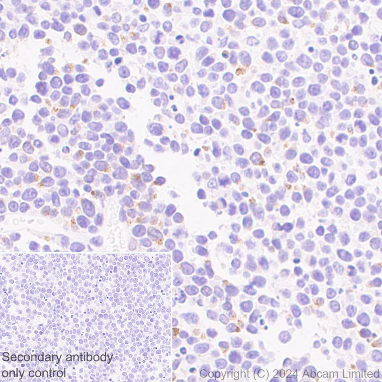 Immunohistochemistry (Formalin/PFA-fixed paraffin-embedded sections) - Anti-RANTES antibody [EPR25836-32] (AB322195)