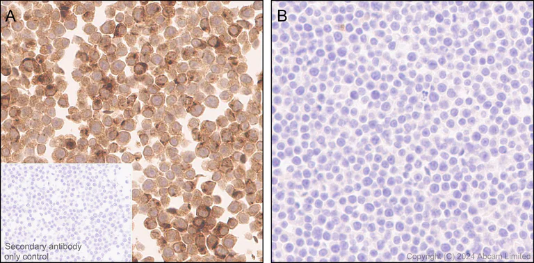 Immunohistochemistry (Formalin/PFA-fixed paraffin-embedded sections) - Anti-RANTES antibody [EPR25836-32] (AB322195)