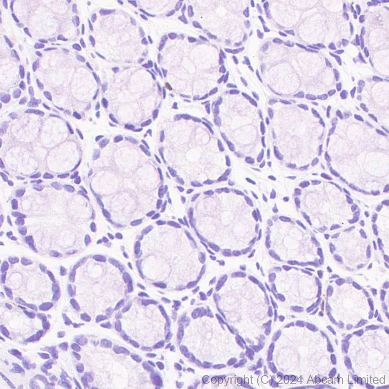 Immunohistochemistry (Formalin/PFA-fixed paraffin-embedded sections) - Anti-RANTES antibody [EPR25836-32] (AB322195)
