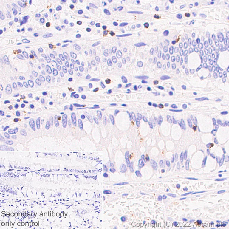 Immunohistochemistry (Formalin/PFA-fixed paraffin-embedded sections) - Anti-RANTES antibody [EPR26519-16] (AB307712)