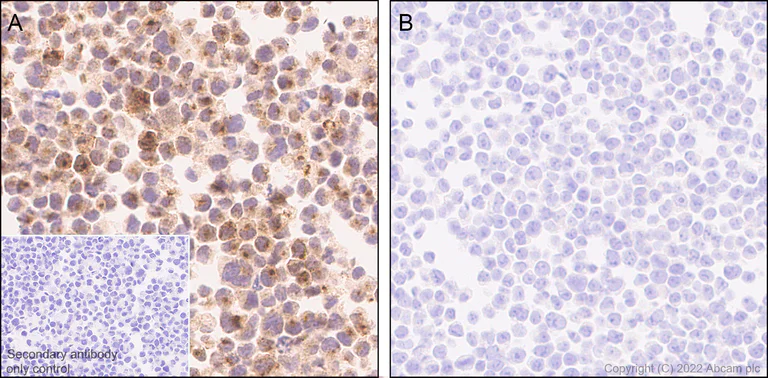 Immunohistochemistry (Formalin/PFA-fixed paraffin-embedded sections) - Anti-RANTES antibody [EPR26519-16] (AB307712)