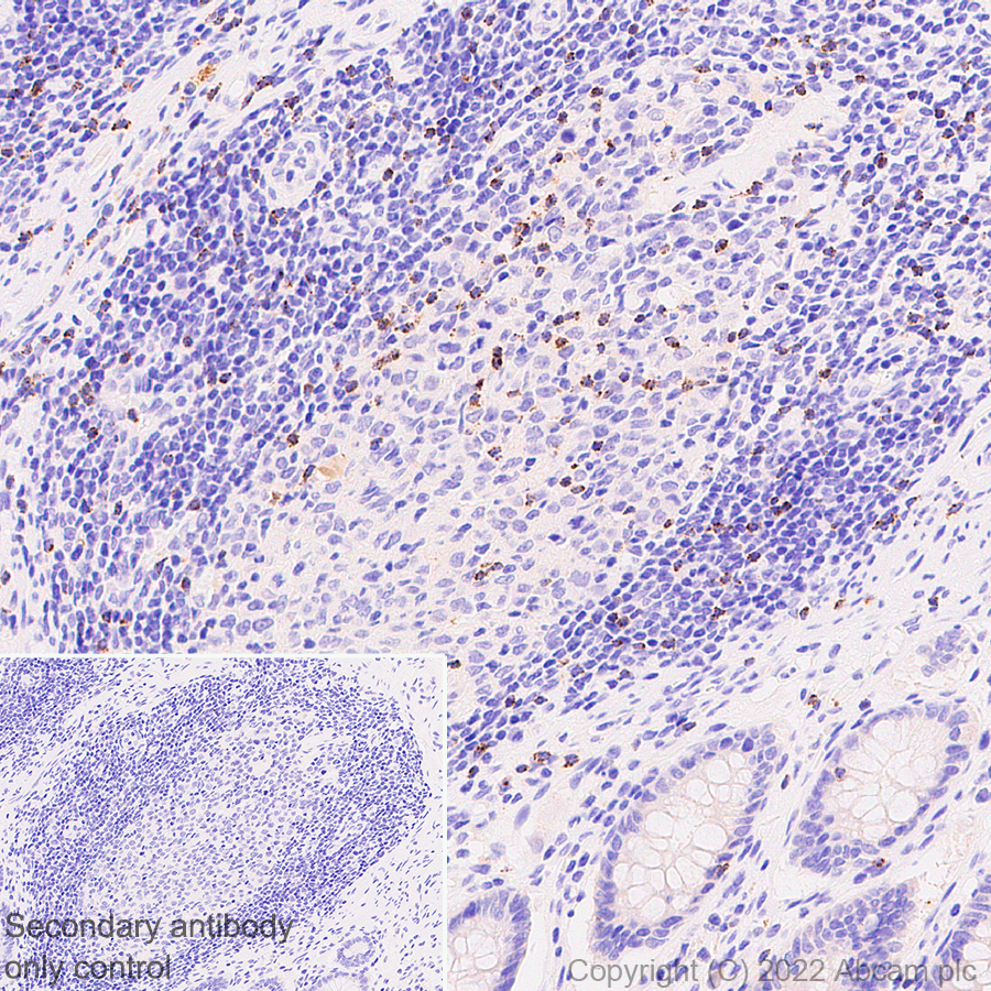 Immunohistochemistry (Formalin/PFA-fixed paraffin-embedded sections) - Anti-RANTES antibody [EPR26519-16] - BSA and Azide free (AB307713), expandable thumbnail
