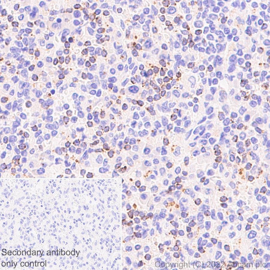 Immunohistochemistry (Formalin/PFA-fixed paraffin-embedded sections) - Anti-RANTES antibody [EPR26519-16] - BSA and Azide free (AB307713), expandable thumbnail