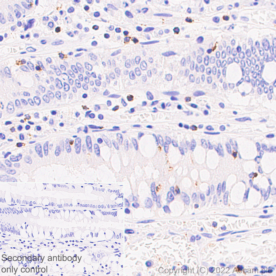 Immunohistochemistry (Formalin/PFA-fixed paraffin-embedded sections) - Anti-RANTES antibody [EPR26519-16] - BSA and Azide free (AB307713), expandable thumbnail