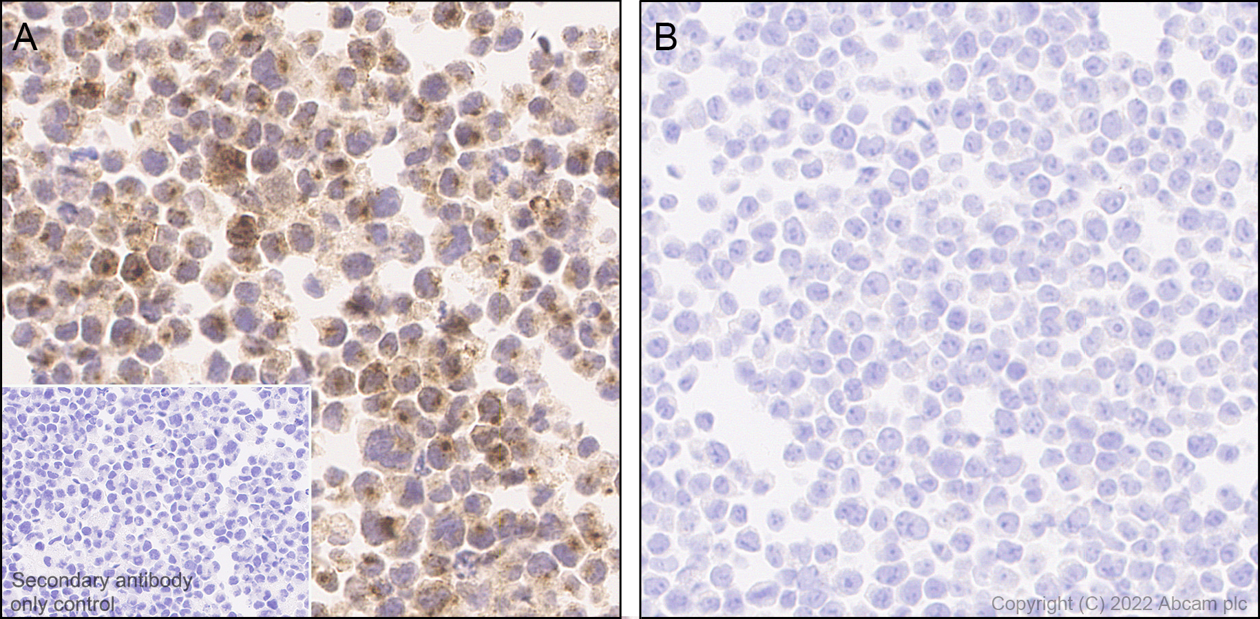 Immunohistochemistry (Formalin/PFA-fixed paraffin-embedded sections) - Anti-RANTES antibody [EPR26519-16] - BSA and Azide free (AB307713), expandable thumbnail