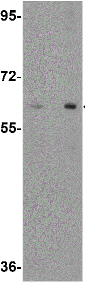 Western blot - Anti-RAP1/RABGEF1 antibody (AB113480), expandable thumbnail