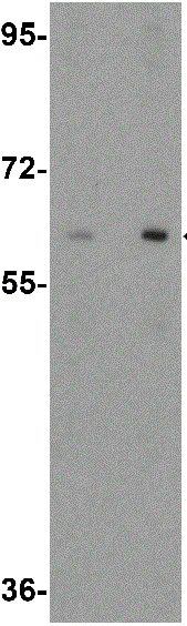 Western blot - Anti-RAP1/RABGEF1 antibody (AB113480)