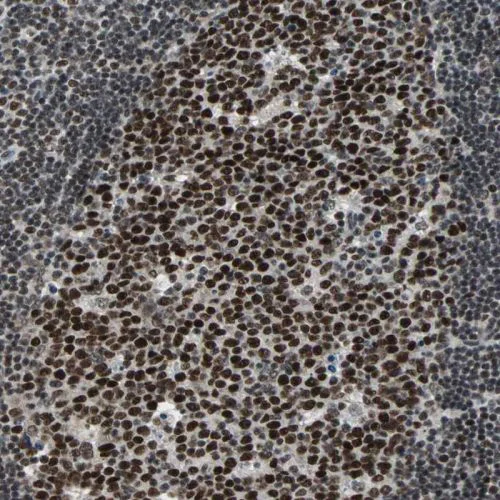 Immunohistochemistry (Formalin/PFA-fixed paraffin-embedded sections) - Anti-RAP1/TERF2IP antibody (AB244289)