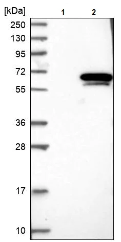 Western blot - Anti-RAP1/TERF2IP antibody (AB244289)