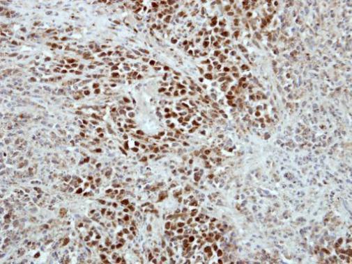 Immunohistochemistry (Formalin/PFA-fixed paraffin-embedded sections) - Anti-RAP1/TERF2IP antibody (AB272863)